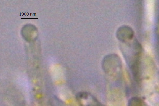 Aecidium euphorbiae5.jpg