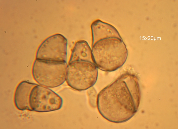 Cymadothea trifolii 2.jpg