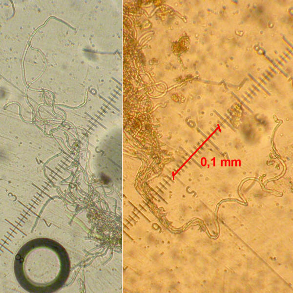 SAustriaca_Excipulum-Haare_100-fach(1).jpg