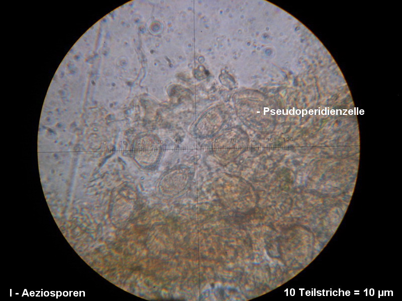 3-Puccinia opizii-M6.JPG