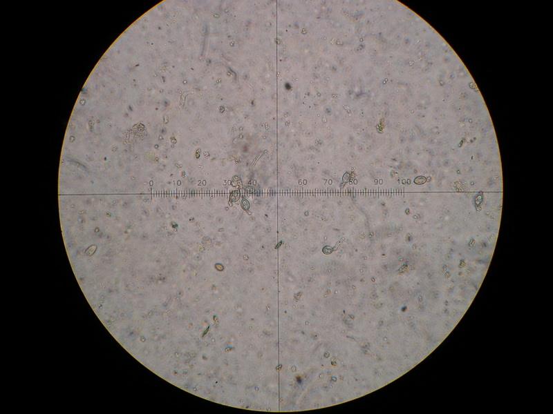 4-Rhamphospora nymphaeae-1.7.7.2.1.1M6-Nymphae spec.JPG
