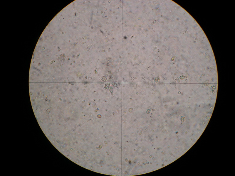 4-Rhamphospora nymphaeae-1.7.7.2.1.1M7-Nymphaespec.JPG