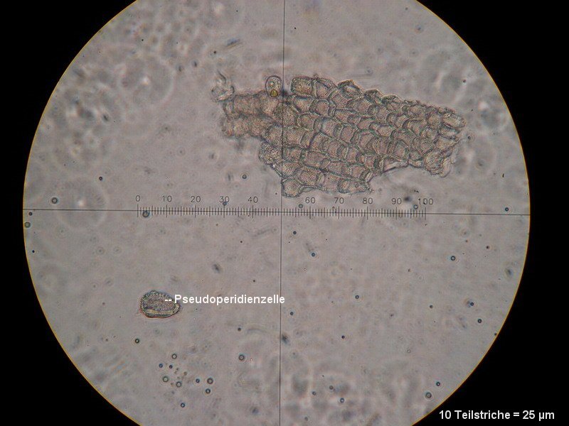 3-Puccinia silvatica-I-M-Pseud1.JPG