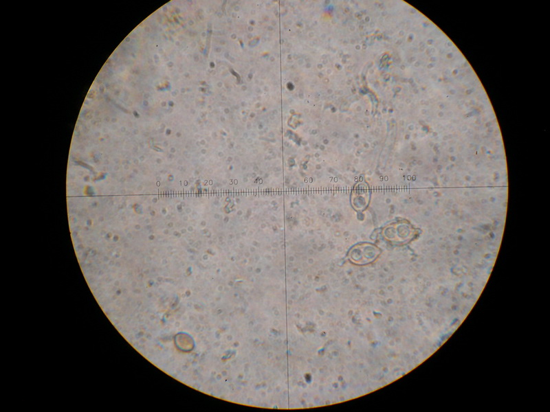 4-Rhamphospora nymphaeae-1.7.7.2.1.1M8-Nymphae spec.JPG