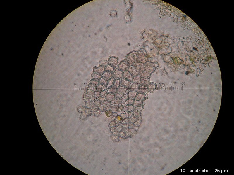 3-Puccinia silvatica-I-M-Pseud2.JPG