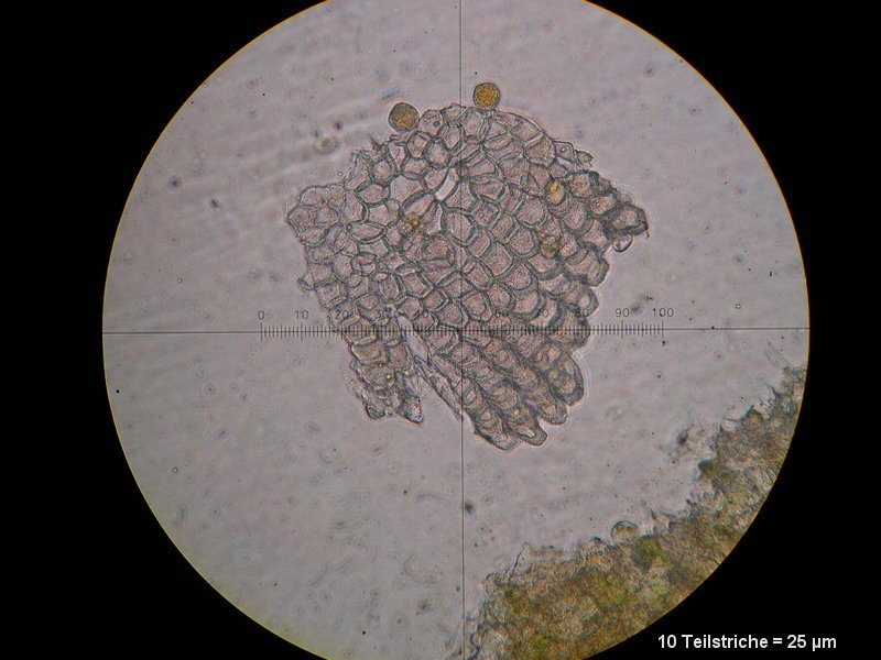 3-Puccinia silvatica-I-M-Pseud3.JPG