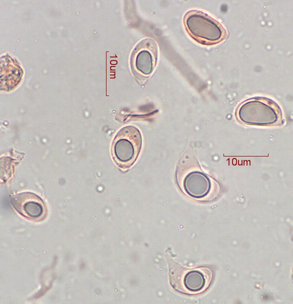 Sebacina_incrustans_Sporen.jpg