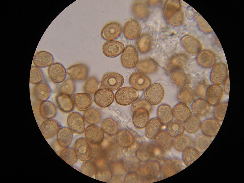 1000er Grötzingen (1).JPG