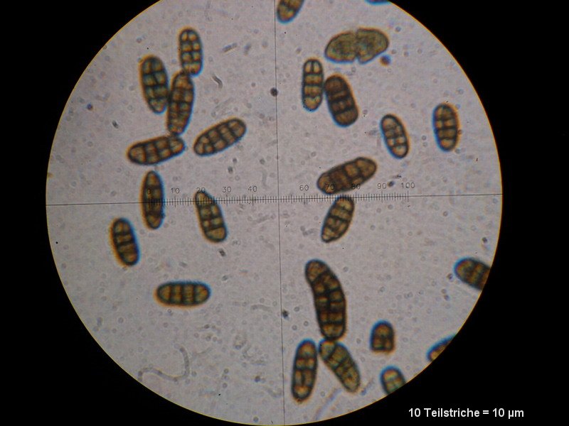Cucurbitaria laburni-M3.JPG