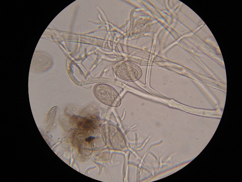 1000er Heister (1).JPG