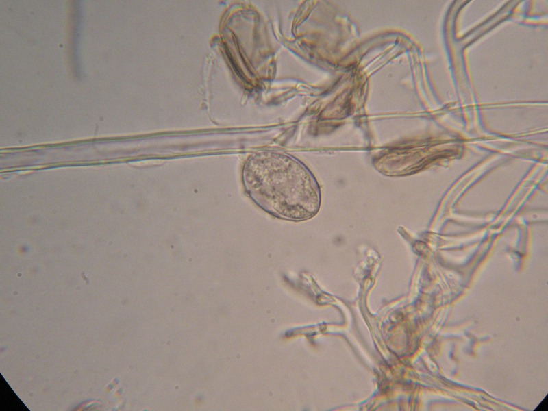 1000er Heister (11).JPG