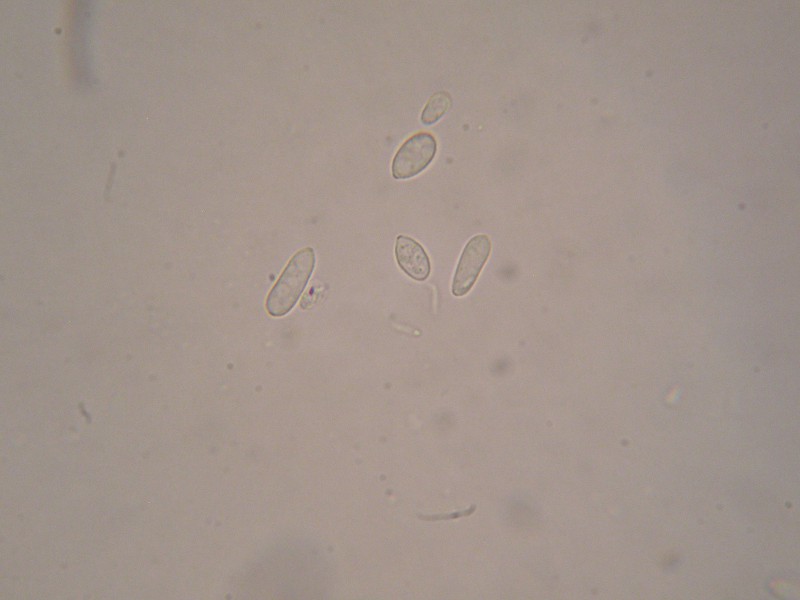 1000er Heister (17).JPG