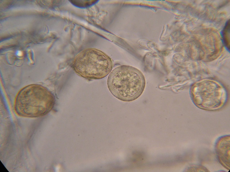 1000er Poggen (30).JPG