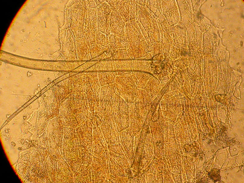 Skalp-Schnitt (Blattoberseite)