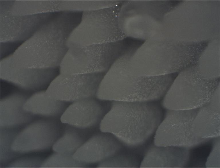 Eispilz_Unterseite 400-fach vergr..JPG