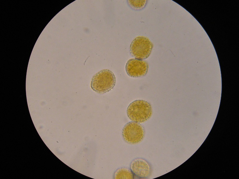 1000er ÖBG (13).JPG