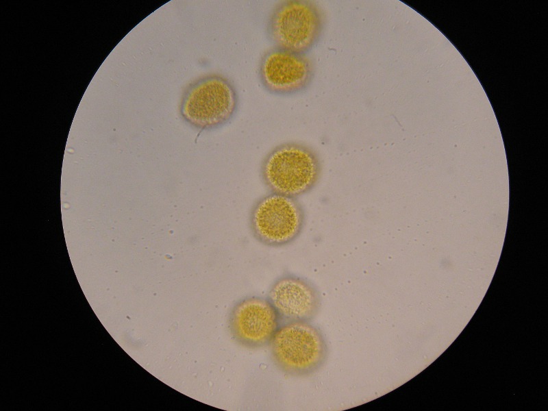 1000er ÖBG (18).JPG