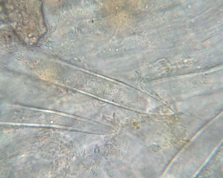 Puccinia coronata_1.JPG