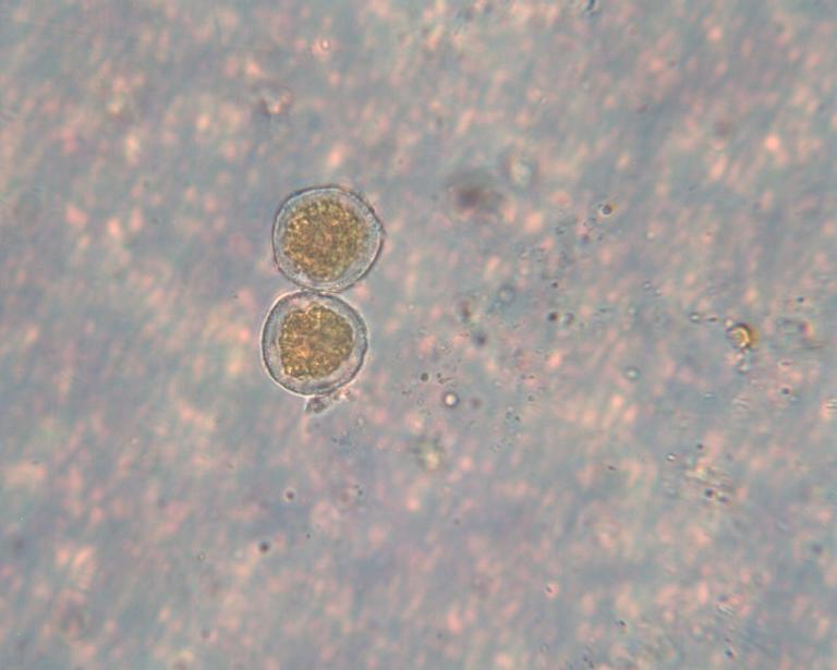 Puccinia coronata_5.JPG