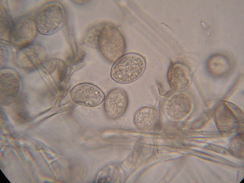 1000er ÖBG (13).JPG