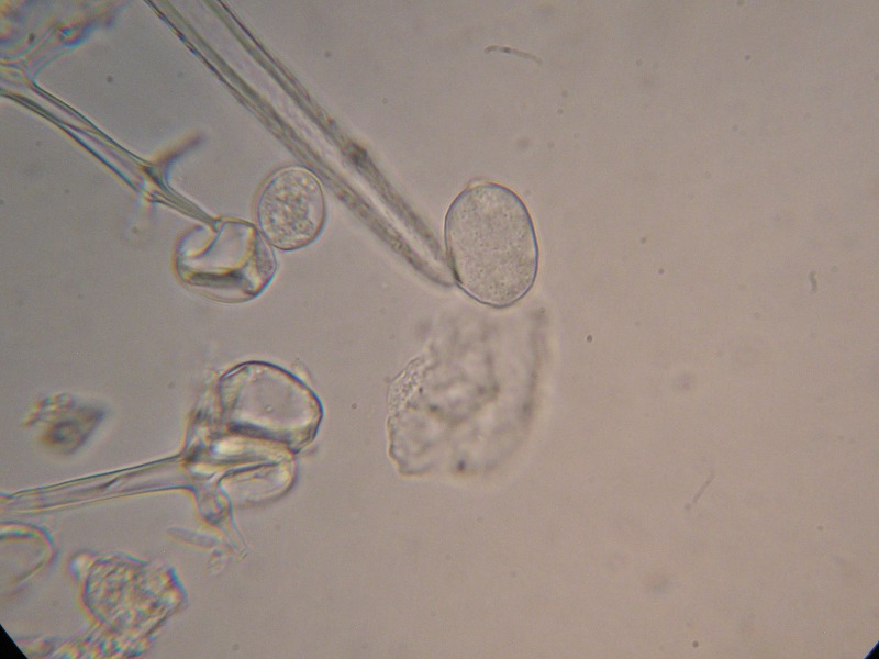 1000er ÖBG (10).JPG